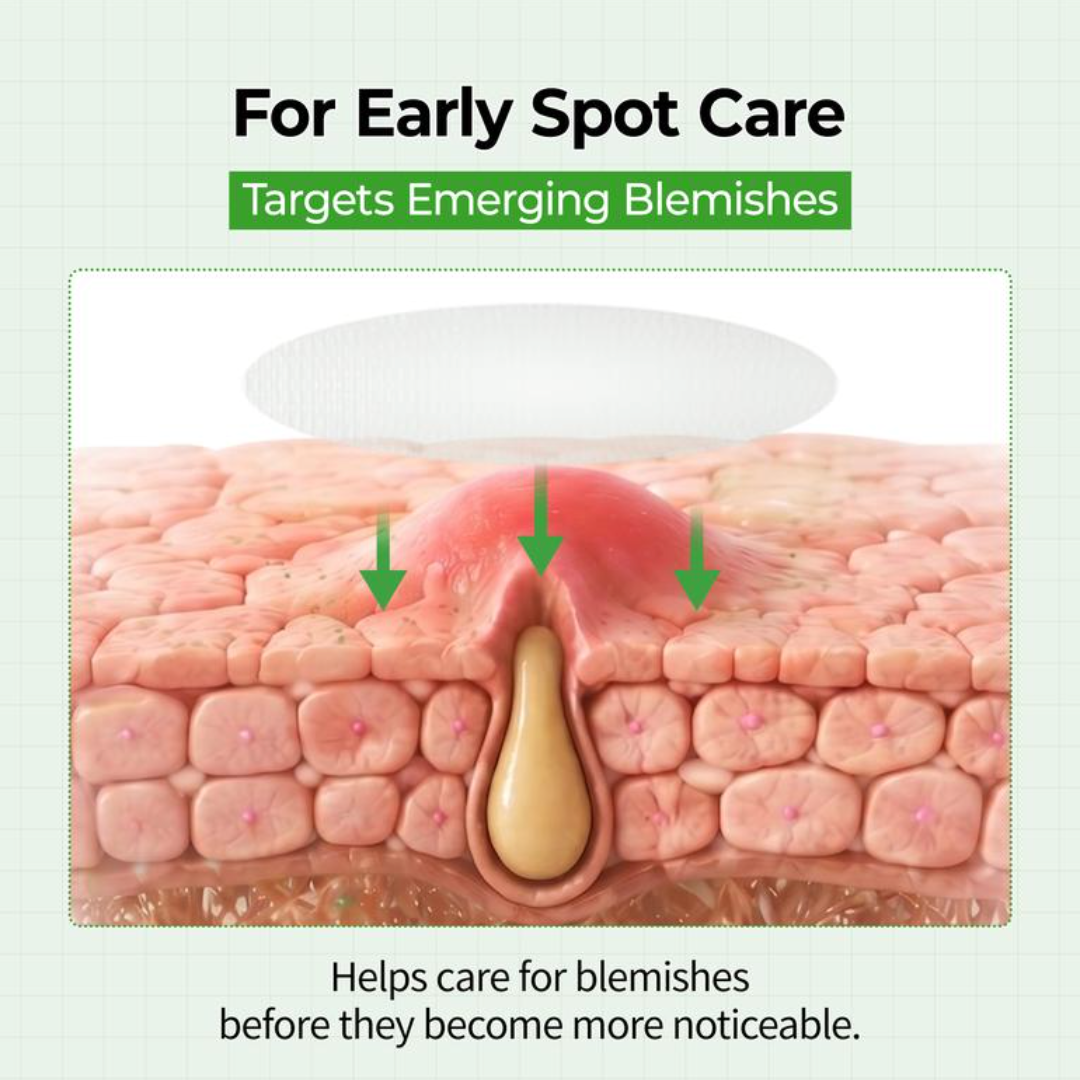 Aevion Health's Advanced Pimple Patch